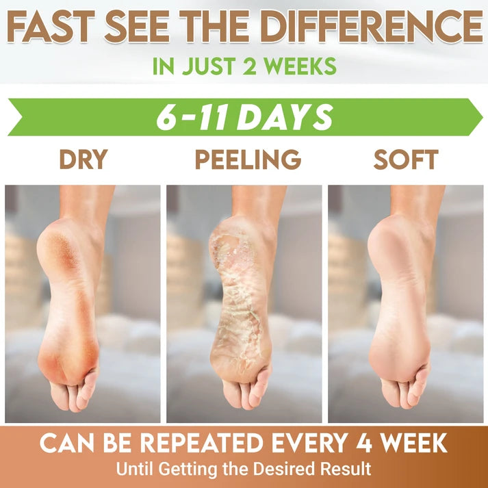 Karma Naturals coconut Foot Peel Mask