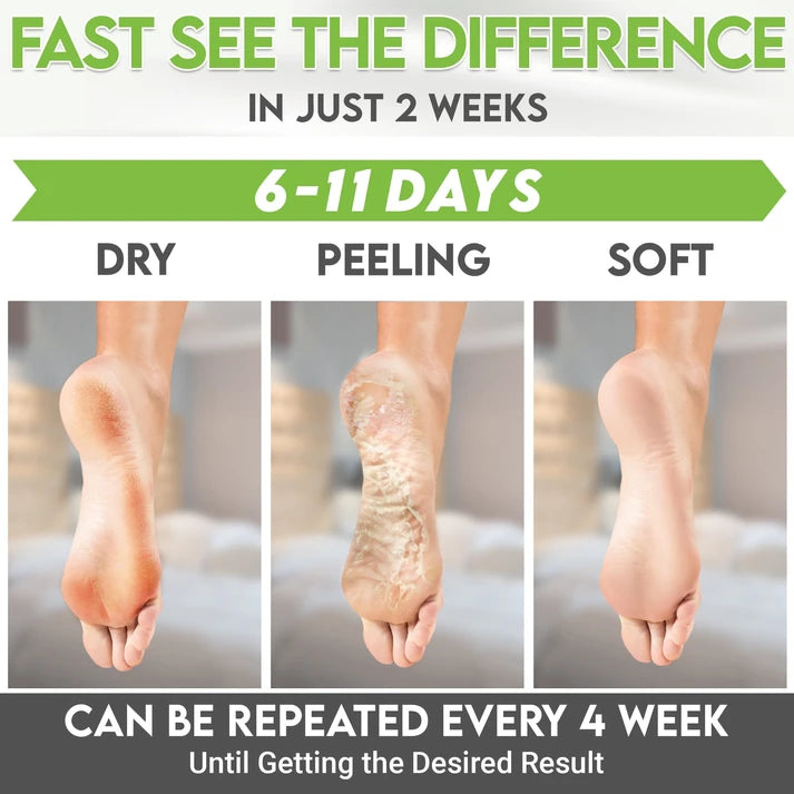 Karma Naturals Green Tea Foot Peel Mask